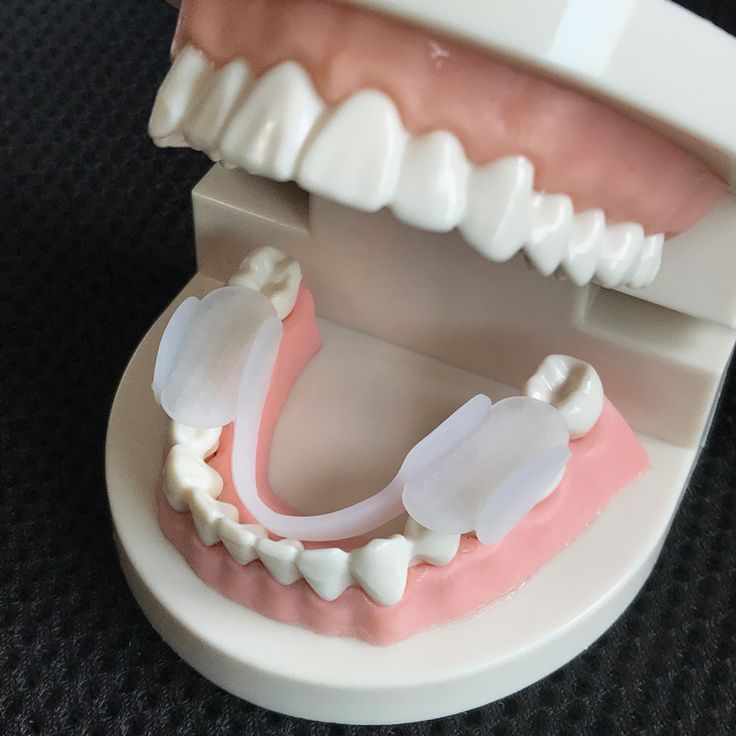 Dental Model (premium